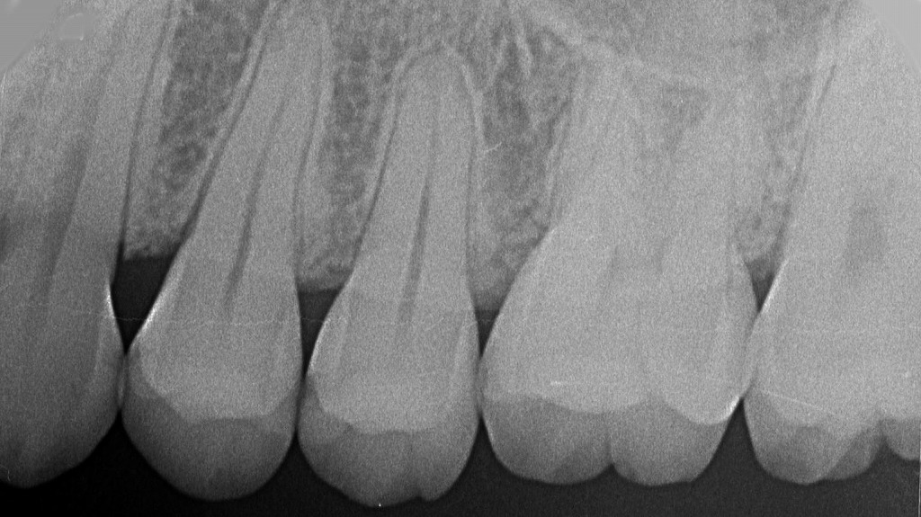 妊娠中の歯科レントゲン撮影｜赤ちゃんへの影響は？