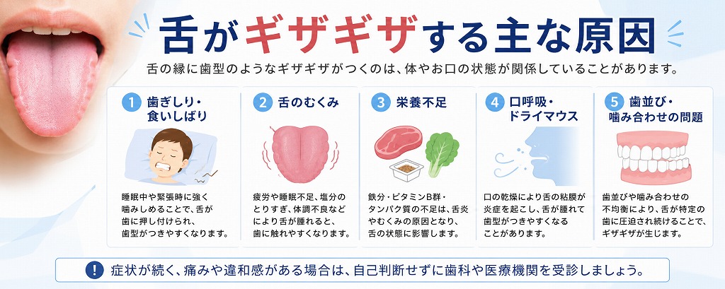 舌がギザギザする主な原因
