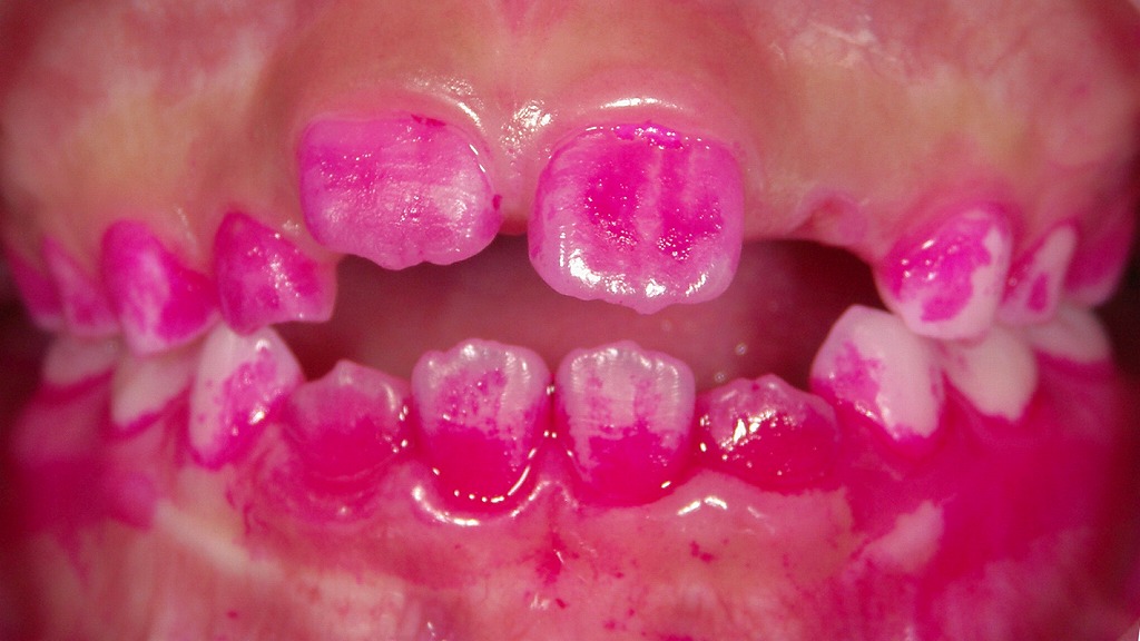 1枚目：初めての染め出し