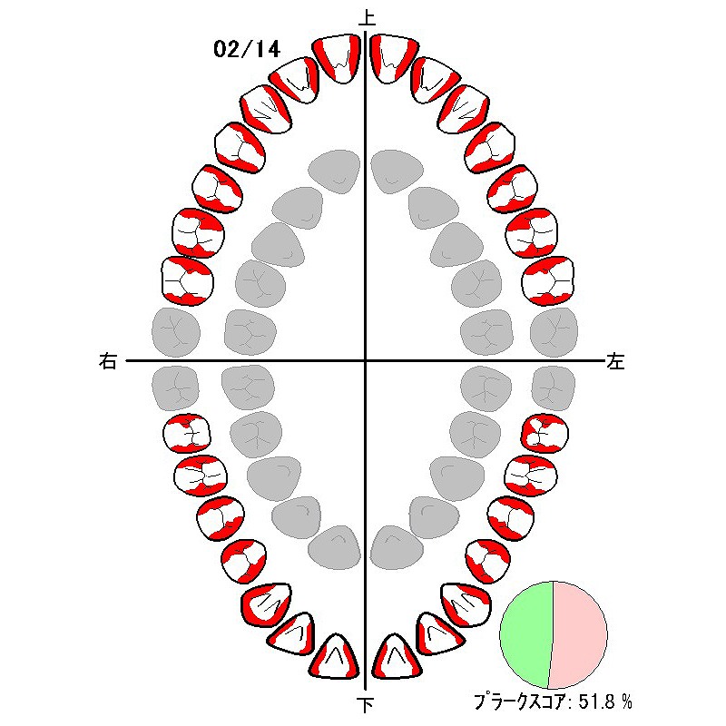 PCR（プラークコントロールレコード）