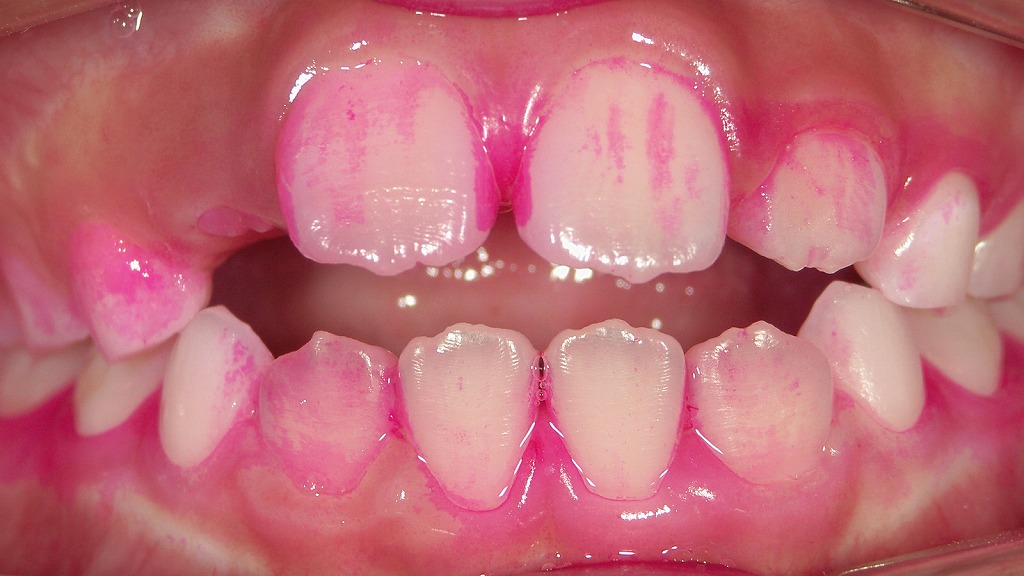 2枚目：改善後の染め出し