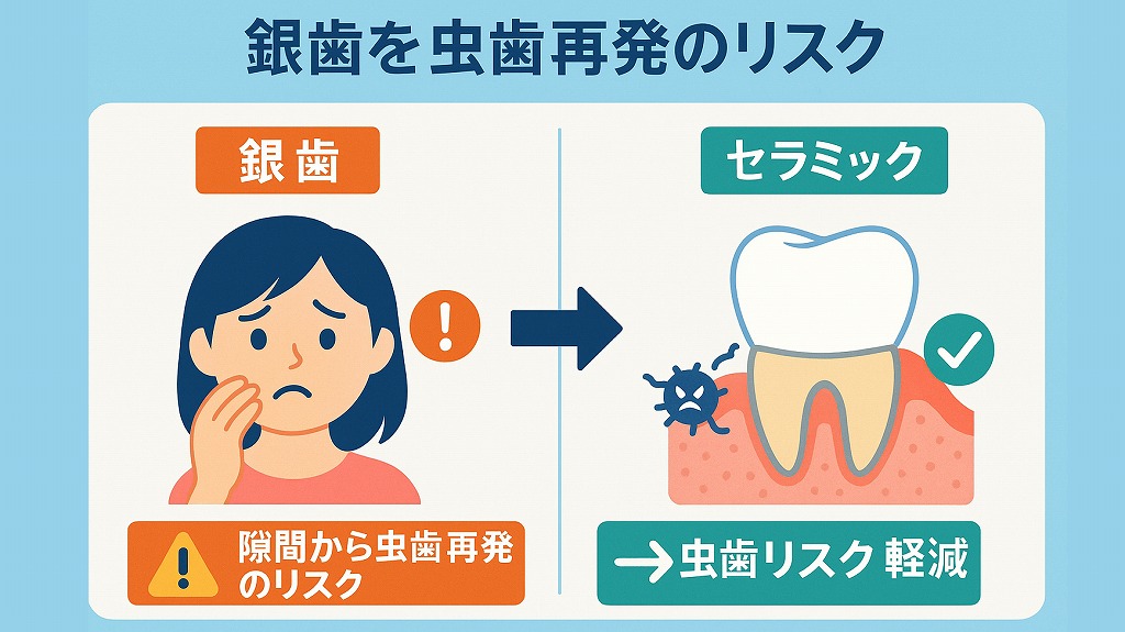 銀歯の虫歯再発のリスク