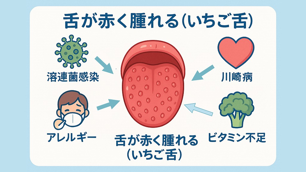 いちご舌の主な原因と関連疾患