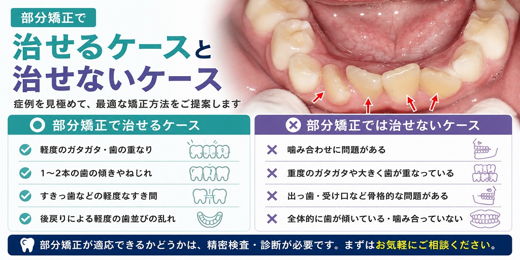 部分矯正で治せるケースと治せないケース