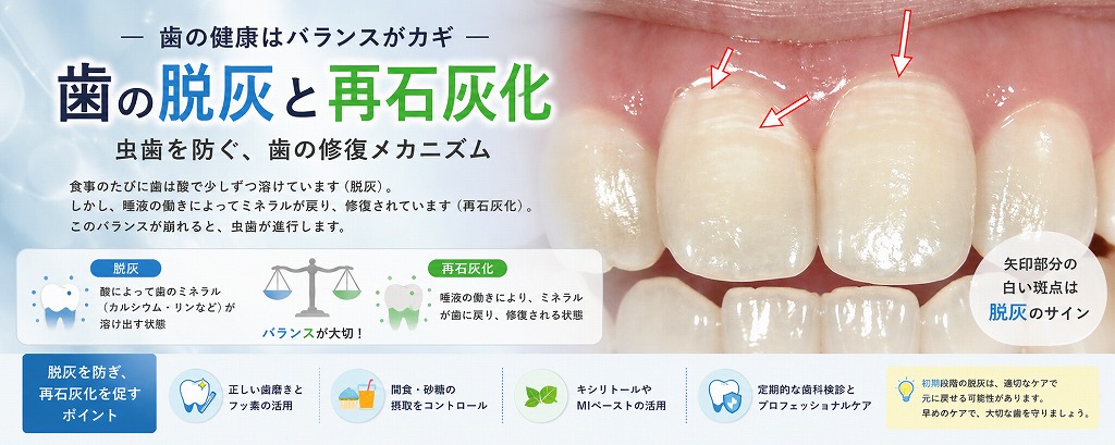 歯の脱灰と再石灰化とは