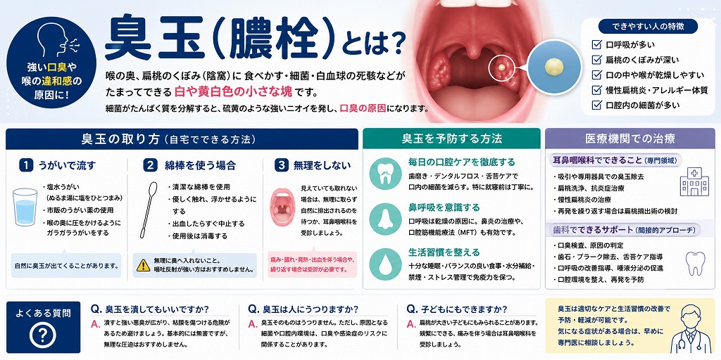 臭玉（膿栓）とは
