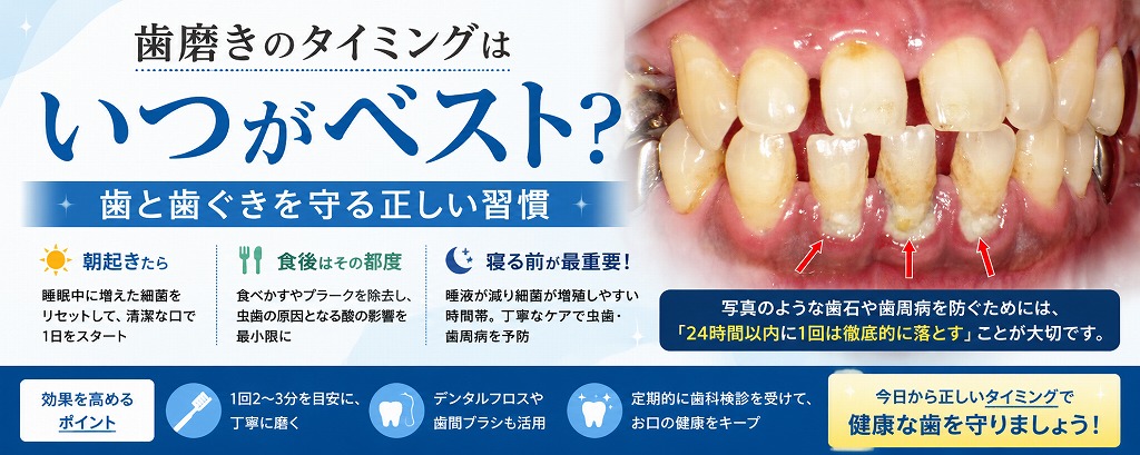 歯磨きのタイミングはいつがベスト？