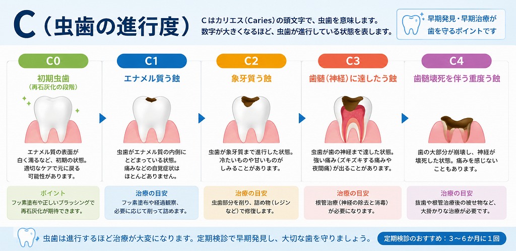 C(虫歯の進行度)
