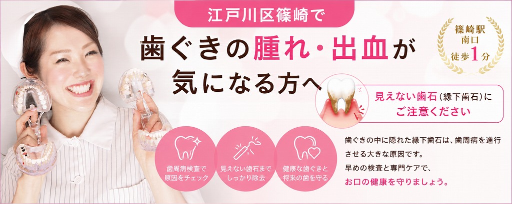 江戸川区篠崎で歯ぐきの腫れ・出血が気になる方へ｜見えない歯石（縁下歯石）にご注意ください