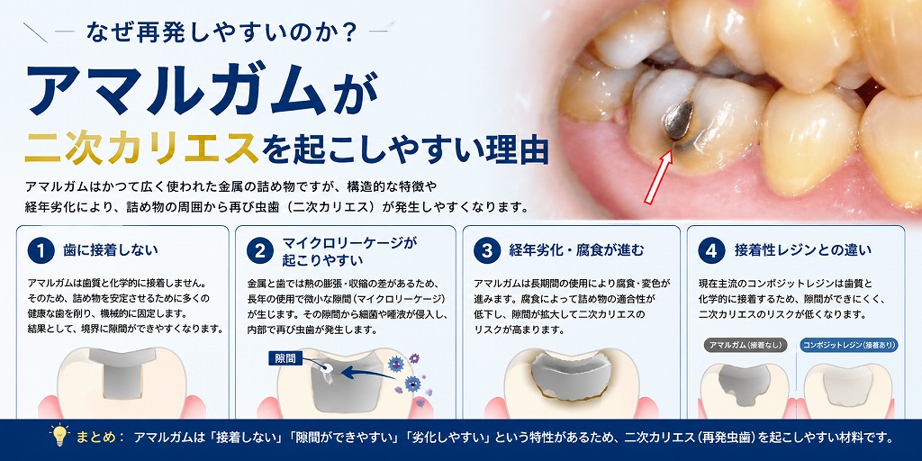 アマルガムが二次カリエスを起こしやすい理由