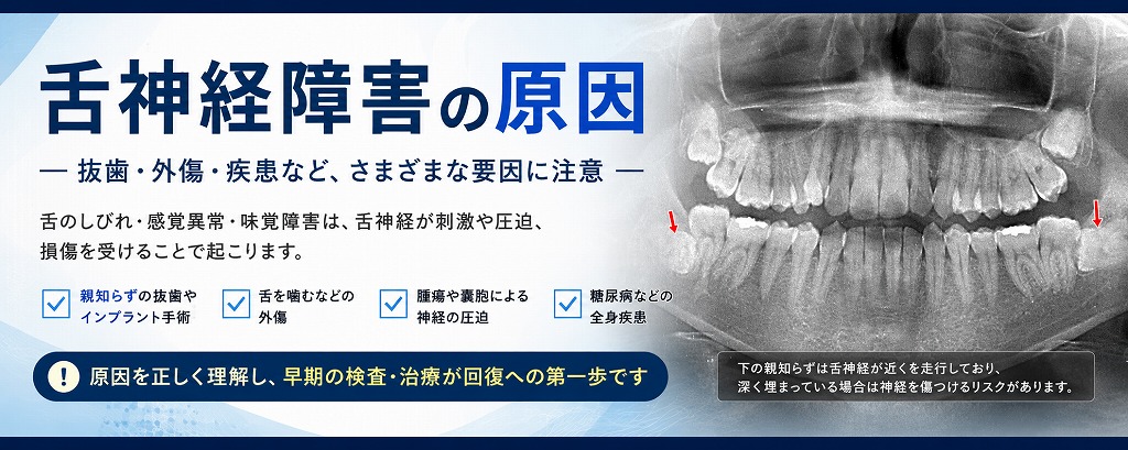 舌神経障害の原因