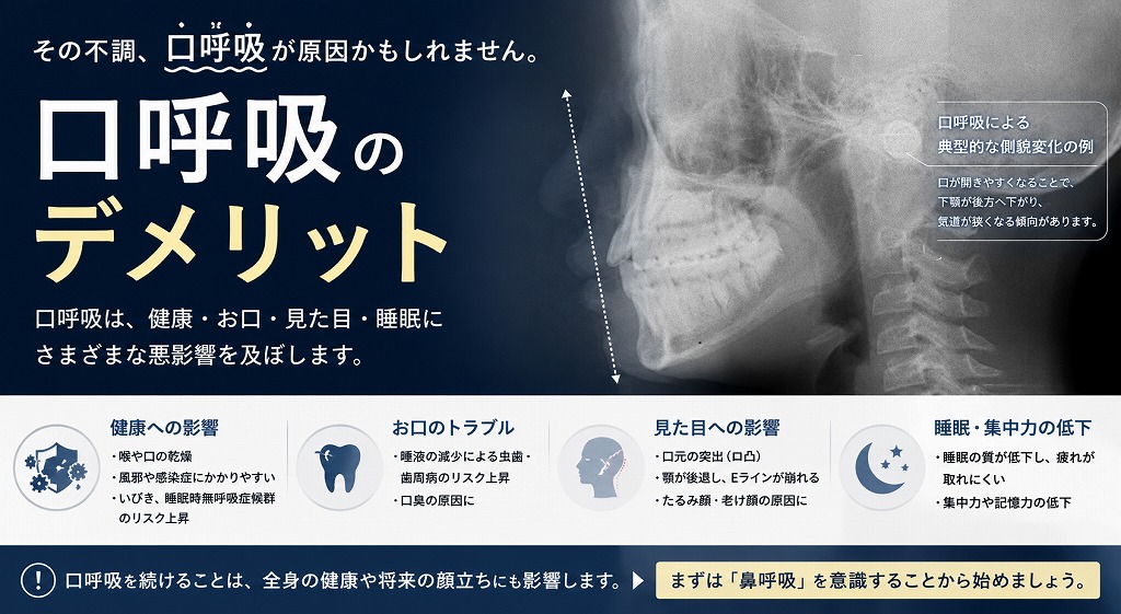 口呼吸のデメリット