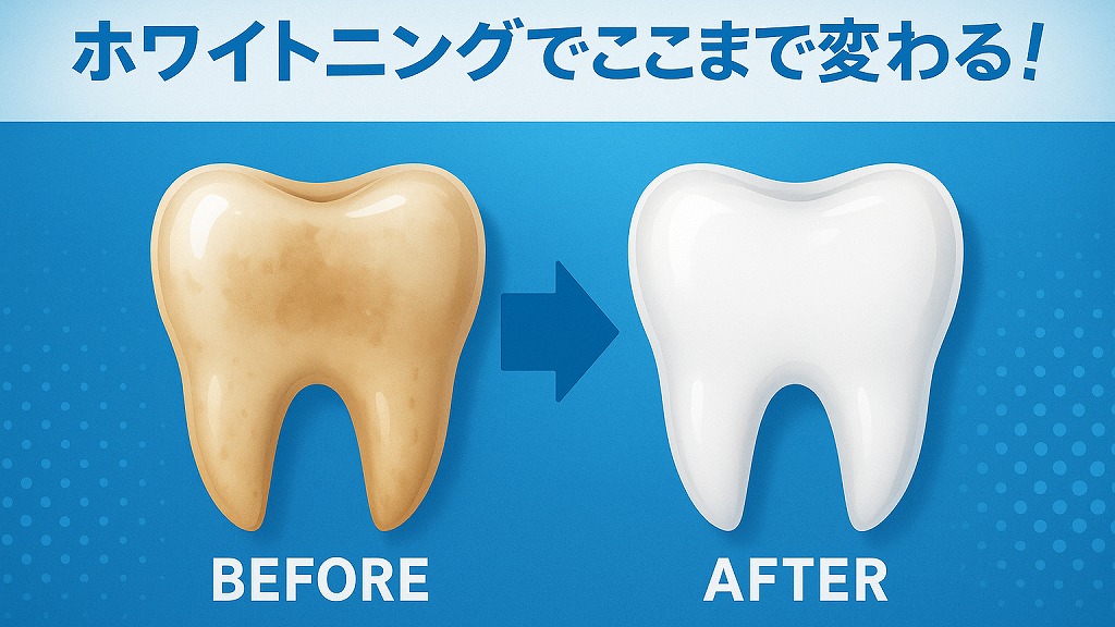 ホワイトニングでここまで変わる