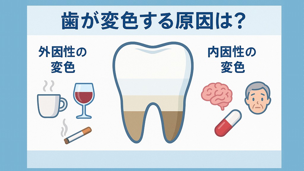 歯が変色する原因は？
