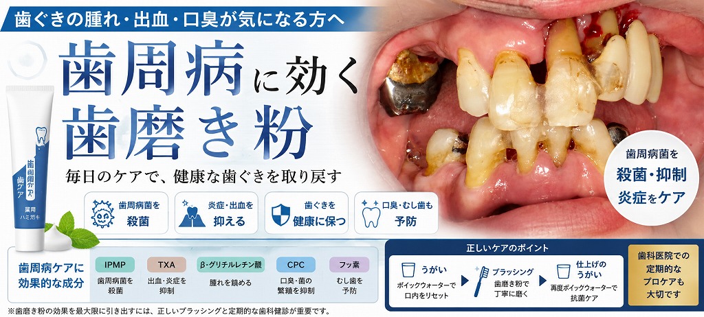 歯周病に効果的な歯磨き粉