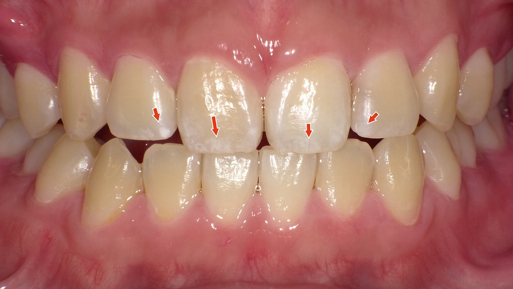 1枚目の画像:術前