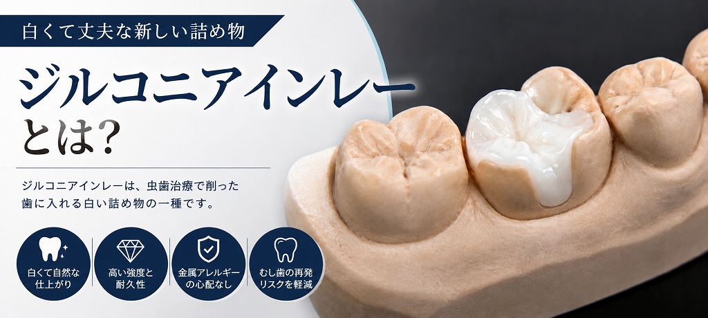 ジルコニアインレーとは？