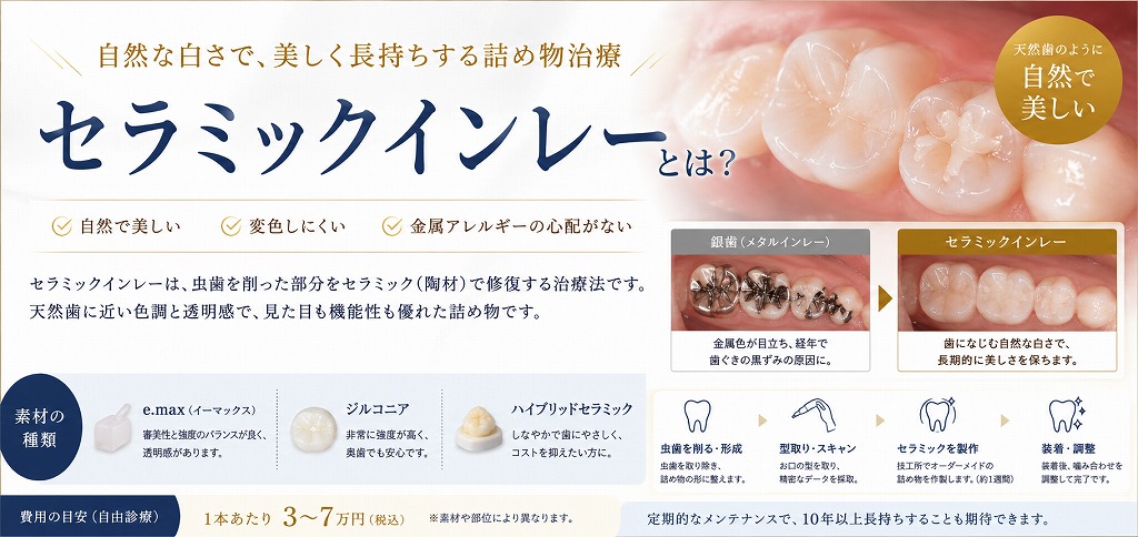 セラミックインレーとは