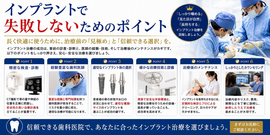 インプラントで失敗しないためのポイント
