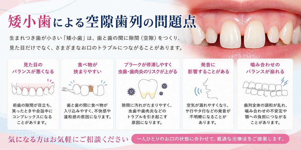 矮小歯による空隙歯列の問題点