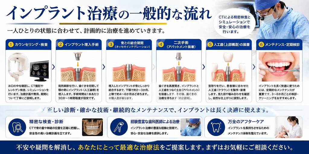 インプラント治療の一般的な流れ