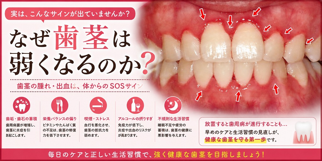 なぜ歯茎は弱くなるのか