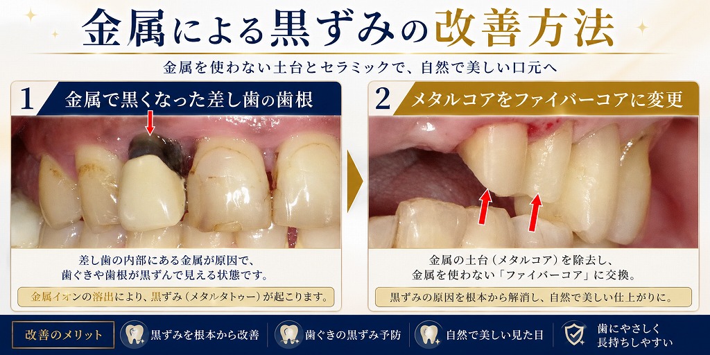 金属による黒ずみの改善方法