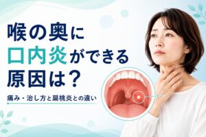 喉の奥に口内炎ができる原因は？｜痛み・治し方と扁桃炎との違い