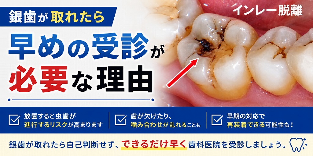 銀歯が取れたら早めの受診が必要な理由
