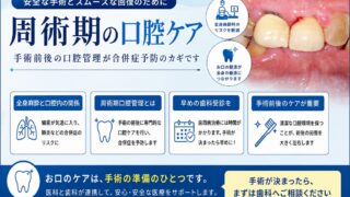 周術期の口腔ケアとは？手術前後に歯科管理が重要な理由を解説