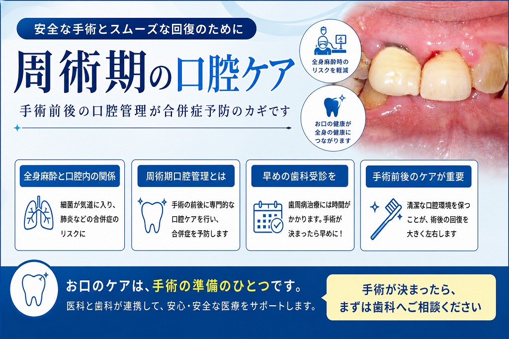 周術期の口腔ケアとは？手術前後に歯科管理が重要な理由を解説
