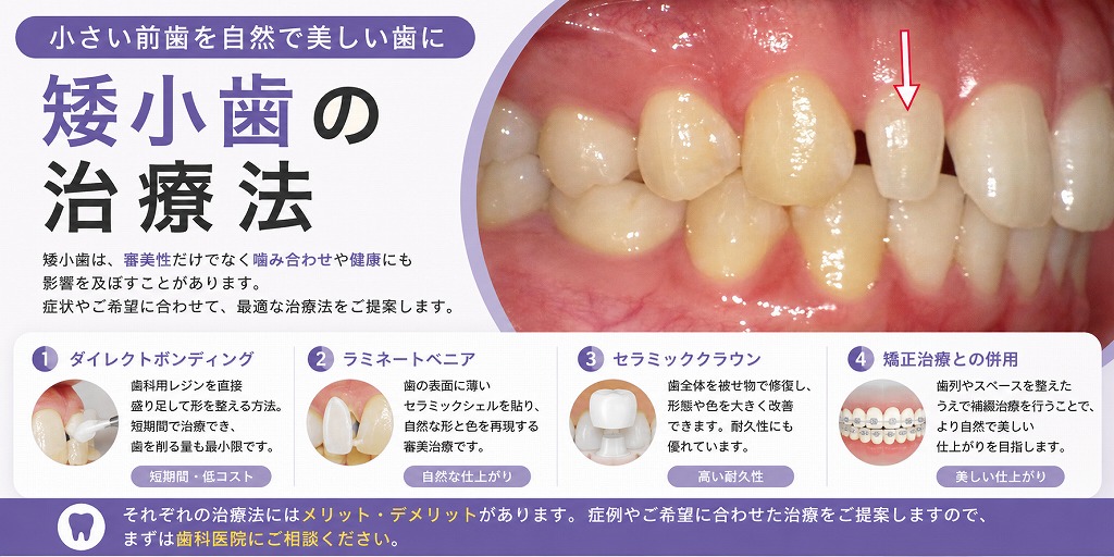 矮小歯の治療法
