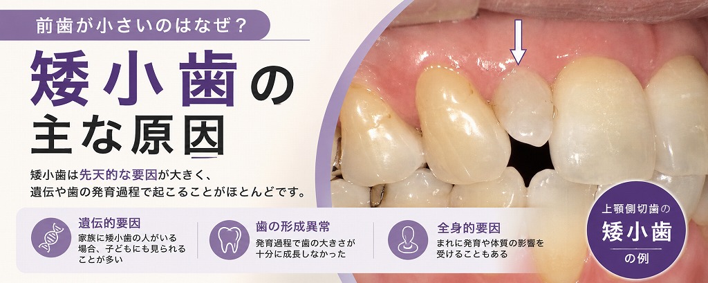 矮小歯の主な原因