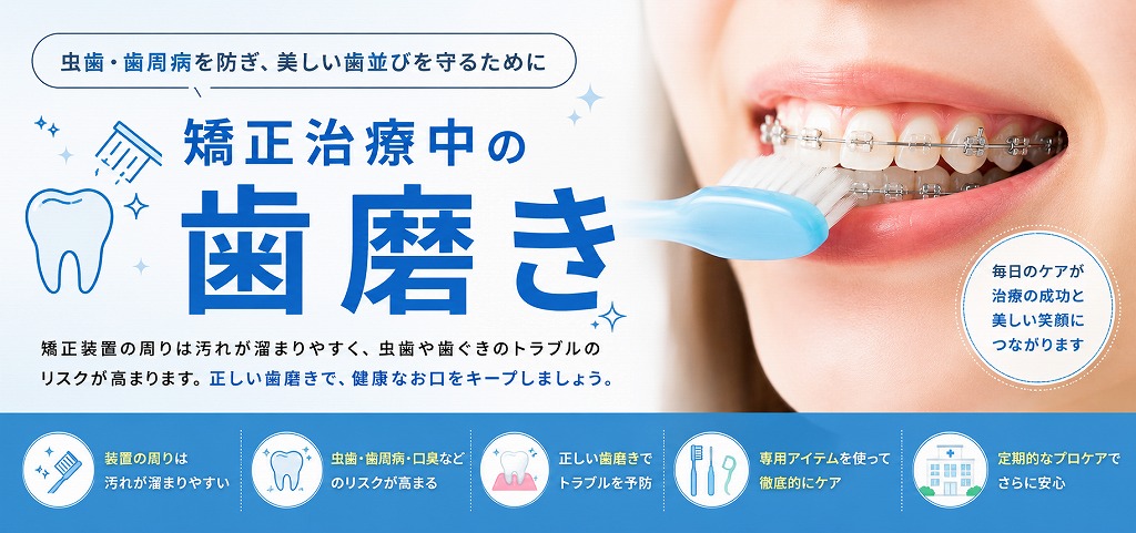 矯正治療中は歯磨き