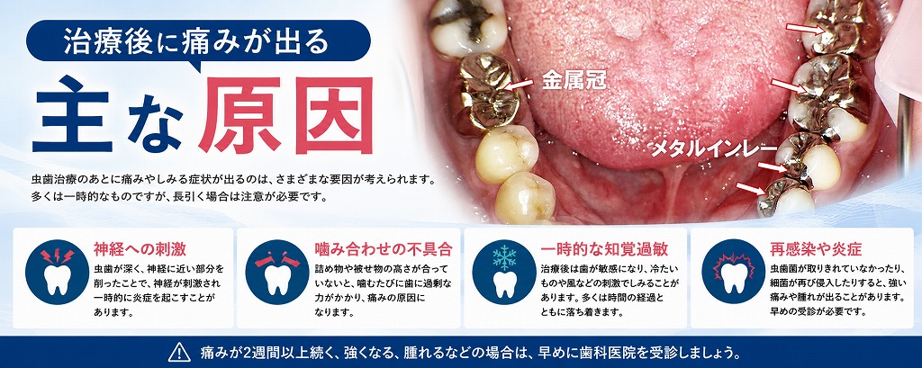 治療後に痛みが出る主な原因
