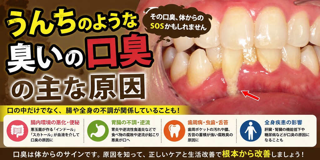 うんちのような口臭の主な原因