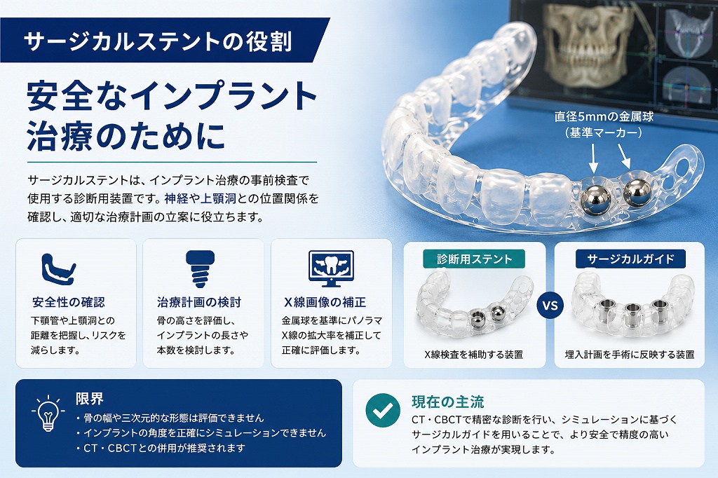 サージカルステントとは？インプラント治療での役割とサージカルガイド