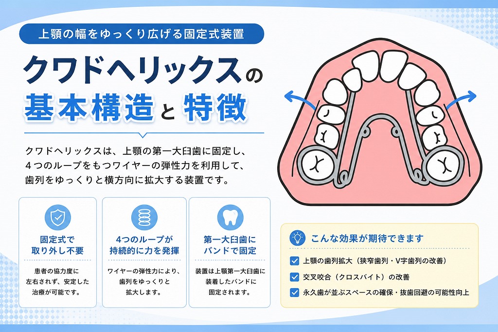 咬合を紐解く クワドヘリックスとは？上顎を広げて歯並びを整える固定式矯正装置