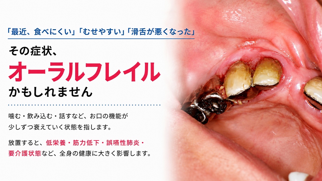 オーラルフレイルとは？