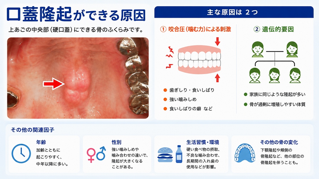 口蓋隆起ができる原因