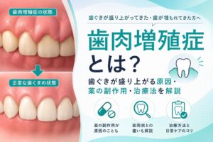 歯肉増殖症とは？歯ぐきが盛り上がる原因・薬の副作用・治療法