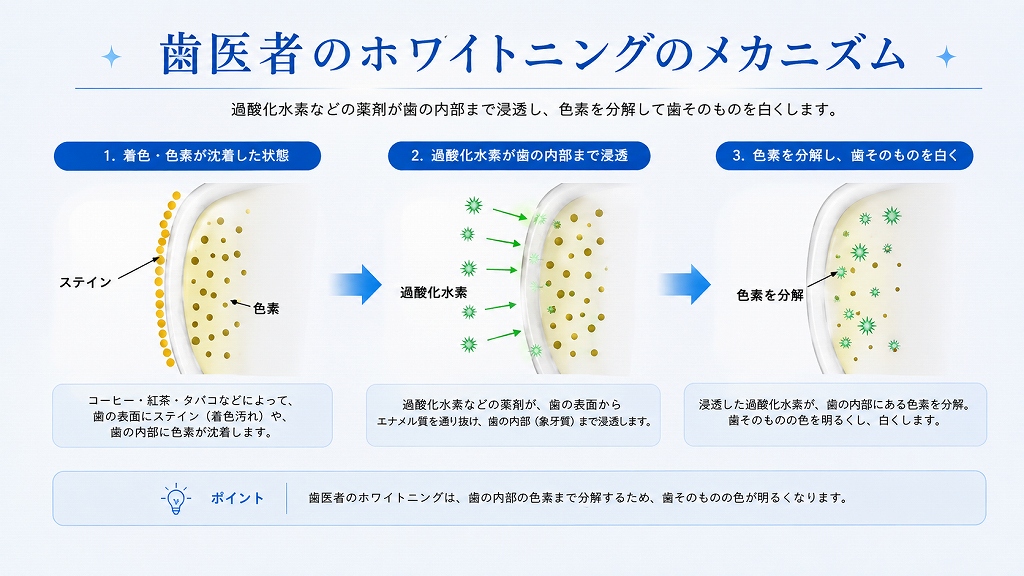 歯医者のホワイトニングのメカニズム