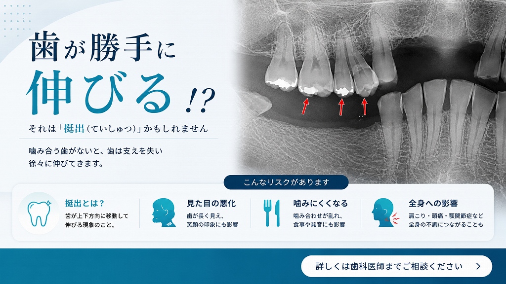 歯が勝手に伸びる「挺出」