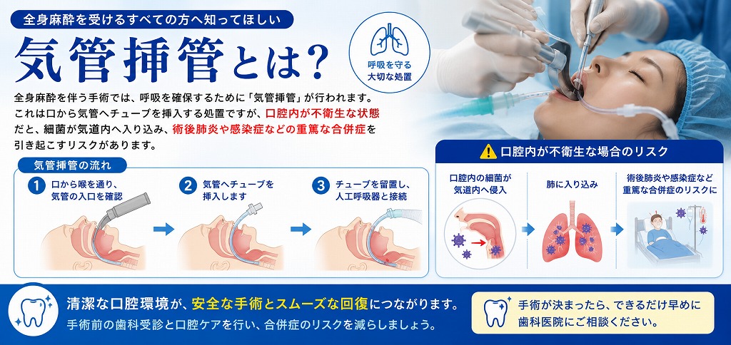 気管挿管とは