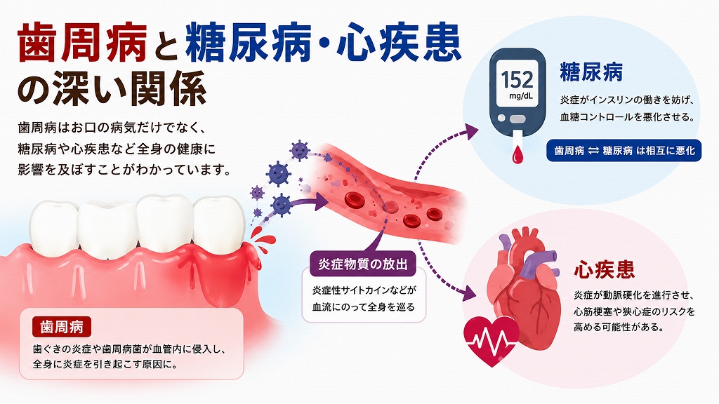 歯周病と糖尿病や心疾患との関係