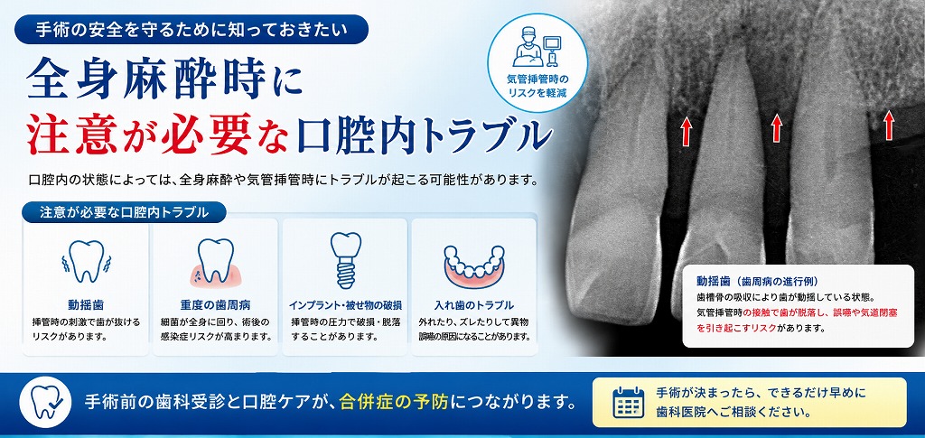 全身麻酔時に注意が必要な口腔内トラブル