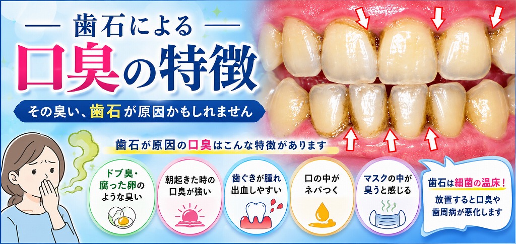 歯石による口臭の特徴