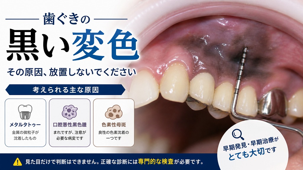【江戸川区篠崎エリア】歯ぐきの黒いシミは放置せずご相談ください