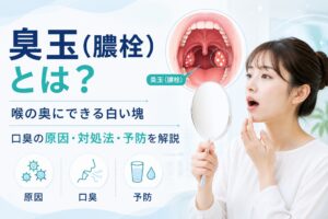 臭玉(膿栓)とは?|口臭の原因・安全な取り方と予防法