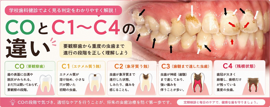 COとC1～C4の違い